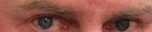 DUI suspect C - eyes